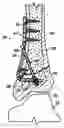 Fig. 01 - Bone plate with toothed aperture
