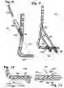 Fig. 04 - Bone plate with toothed aperture