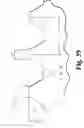 Fig. 22 - Open intervertebral spacer