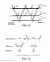 Fig. 05 - Stereotactic apparatus and methods