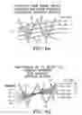 Fig. 06 - Stereotactic apparatus and methods