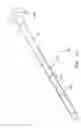 Fig. 09 - Method and apparatus for anastomosis including expandable anchor