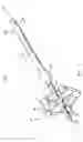 Fig. 03 - Method and apparatus for radical prostatectomy anastomosis