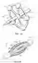 Fig. 04 - Method and apparatus for radical prostatectomy anastomosis