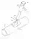 Fig. 01 - Anastomosis system utilizing an access port
