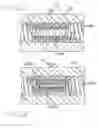 Fig. 04 - Multi-layer coaxial vaso-occlusive device