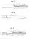 Fig. 03 - Vascular embolic filter exchange devices and methods of use thereof