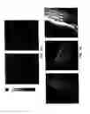 Fig. 08 - Electrically induced vessel vasodilation