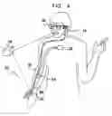 Fig. 04 - Actuation and control of limbs through motor nerve stimulation