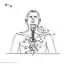 Fig. 01 - Apparatus and methods for cooling a region within the body