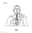 Fig. 02 - Apparatus and methods for cooling a region within the body