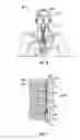 Fig. 09 - Apparatus and methods for cooling a region within the body