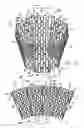 Fig. 11 - Cardiac harness and method of delivery by minimally invasive access