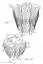Fig. 12 - Cardiac harness and method of delivery by minimally invasive access