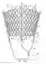 Fig. 14 - Cardiac harness and method of delivery by minimally invasive access