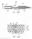 Fig. 22 - Cardiac harness and method of delivery by minimally invasive access
