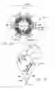 Fig. 25 - Cardiac harness and method of delivery by minimally invasive access