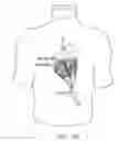 Fig. 31 - Cardiac harness and method of delivery by minimally invasive access