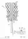 Fig. 41 - Cardiac harness and method of delivery by minimally invasive access