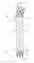 Fig. 01 - Inflatable porous implants and methods for drug delivery