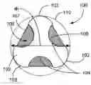 Fig. 01 - Method and apparatus for stent deployment with enhanced delivery of bioactive agents