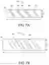 Fig. 09 - Method and apparatus for stent deployment with enhanced delivery of bioactive agents