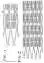 Fig. 07 - Helical stent for branched vessel prosthesis