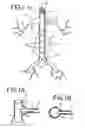 Fig. 02 - Aorta and branch vessel stent grafts and method