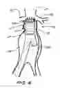 Fig. 04 - Device for use in intraluminal grafting