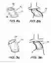 Fig. 07 - Device for use in intraluminal grafting