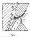 Fig. 02 - Antimicrobial indwelling voice prosthesis