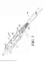Fig. 04 - Expanding ligament graft fixation system and method