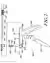 Fig. 07 - Expanding ligament graft fixation system and method