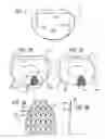 Fig. 02 - Method for installation of manufactured implants shaped to conform to a prepared implantation space
