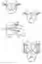 Fig. 05 - Spinal arthroplasty device and method