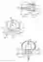 Fig. 06 - Spinal arthroplasty device and method