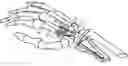 Fig. 01 - Wrist articulation prosthesis and set of elements allowing building of this prosthesis