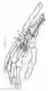 Fig. 02 - Wrist articulation prosthesis and set of elements allowing building of this prosthesis