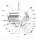 Fig. 02 - Expandable, supporting acetabular cup