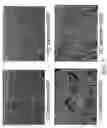Fig. 09 - Peritoneal regeneration with acellular pericardial patch
