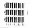 Fig. 07 - Astrocyte modulated genes and uses thereof