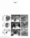 Fig. 03 - Methods for diagnosing and treating diseases and conditions associated with protein kinase Cλ