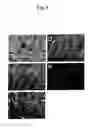 Fig. 06 - Methods for diagnosing and treating diseases and conditions associated with protein kinase Cλ