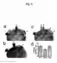 Fig. 07 - Methods for diagnosing and treating diseases and conditions associated with protein kinase Cλ