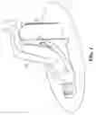 Fig. 04 - Postcoital positioning pillow