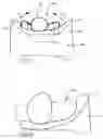 Fig. 05 - Supportive upper body constraint device