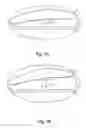 Fig. 06 - Pillow for preventing snoring