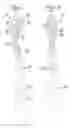 Fig. 02 - Toothbrush for creating a whitening effect