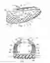 Fig. 02 - Article of footwear with variable support structure