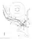 Fig. 09 - Loader assembly, combination motor vehicle and loader assembly, hydraulic cylinders and methods for operating a loader assembly